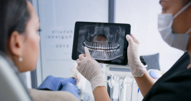 Licensed Tooth Extraction service in Merrillville, IN - Smile Center Dentistry